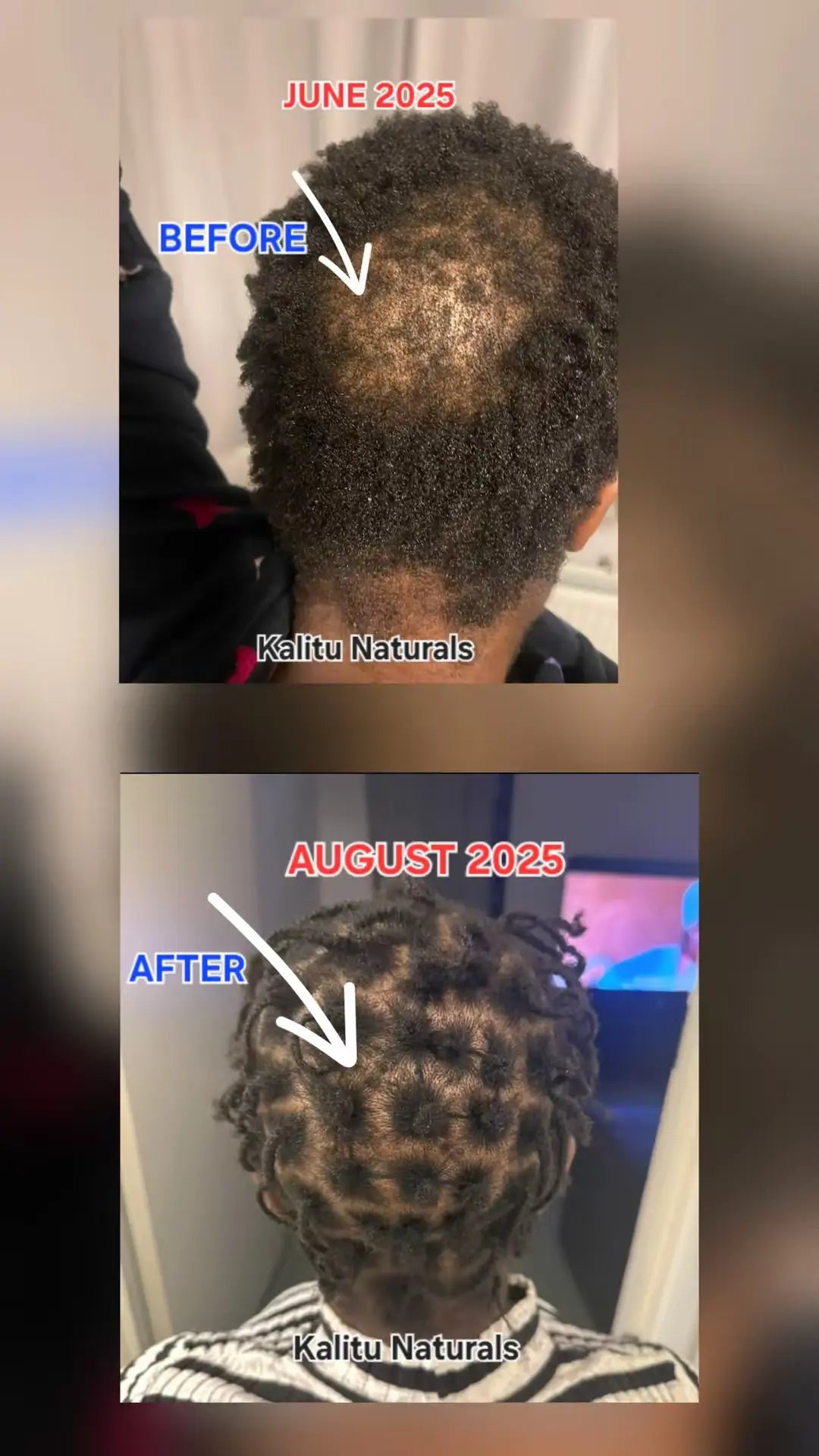 Before and after comparison of hair growth using Kaltu Naturals products.